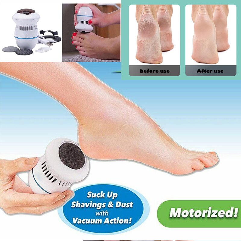Electric Foot Dead Skin Callus Remover Machine